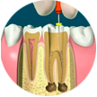 Ícone de Endodontia