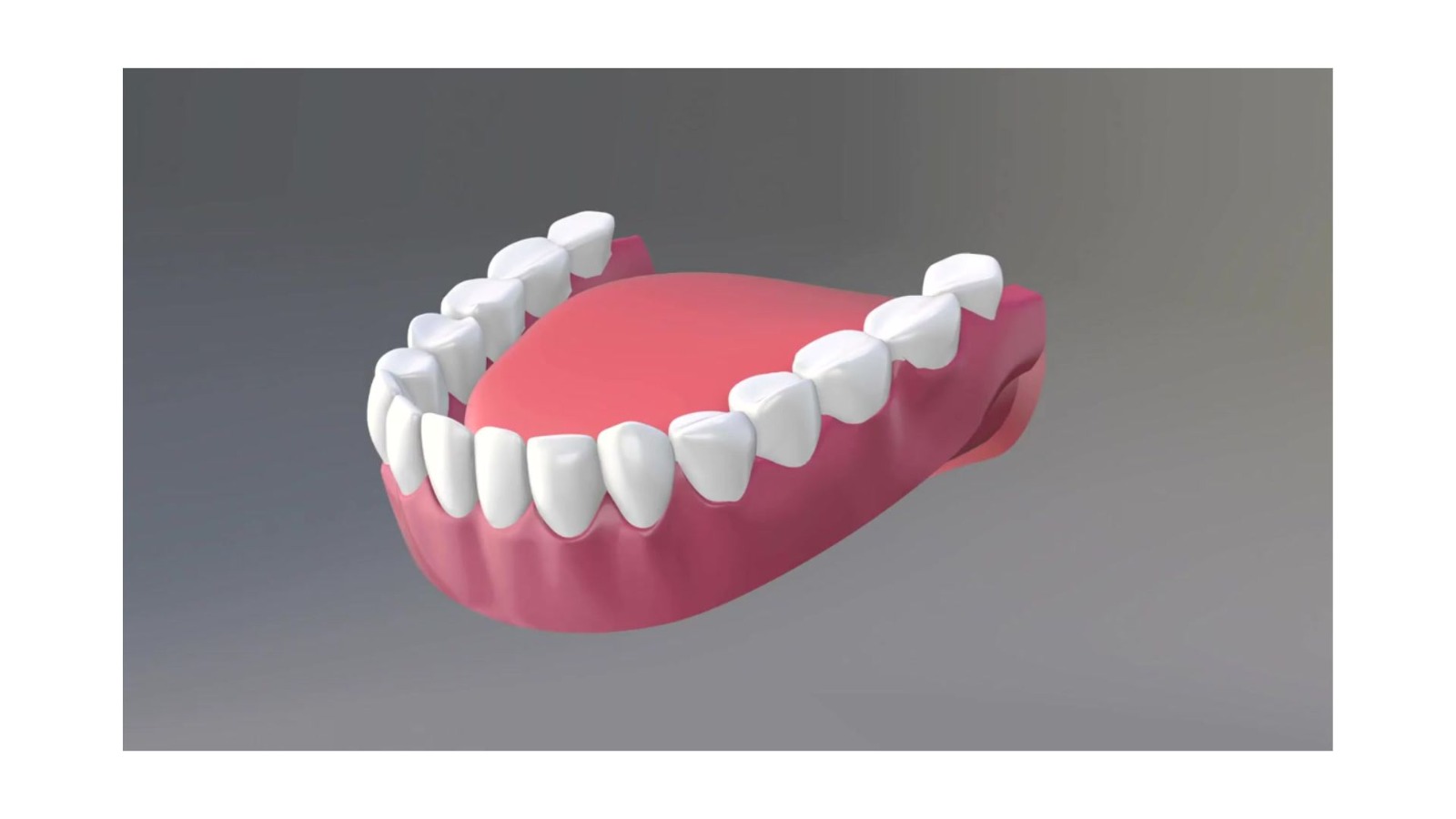Prótese dentária total